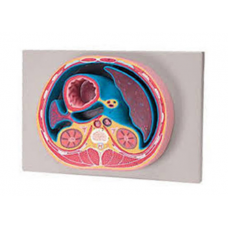 SCHEMATIC CROSS SECTION THROUGH ABDOMEN T12